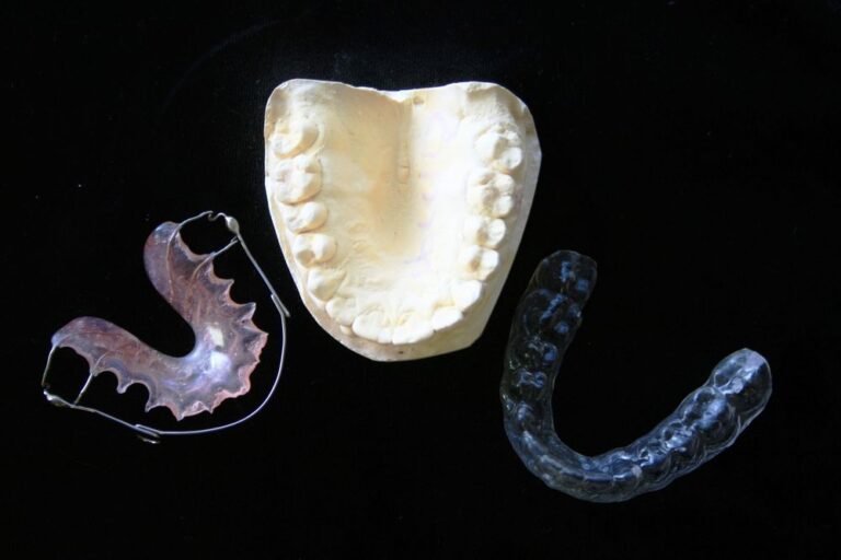 Clear Aligners (Full Treatment)