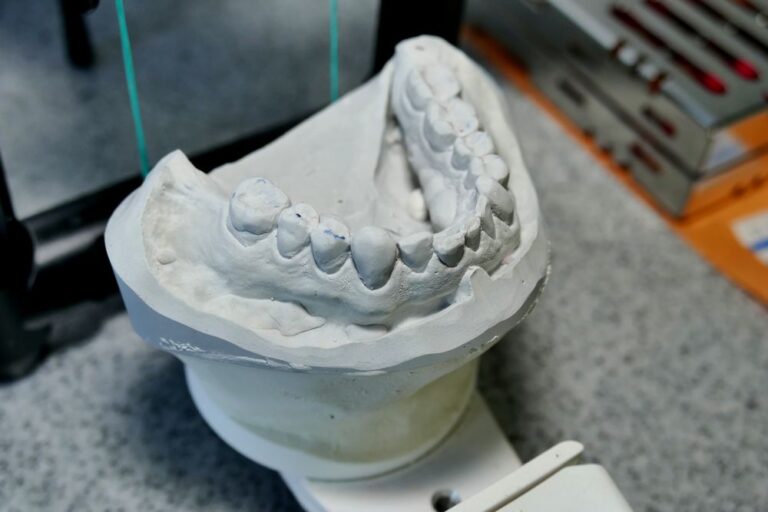 Orthodontic Consultation & 3D Scan