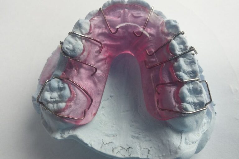 Retainers (Upper & Lower)