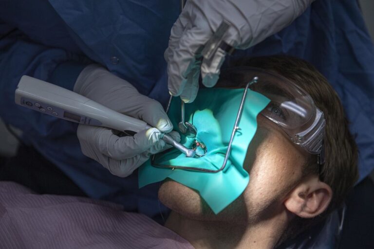 Root Canal Treatment